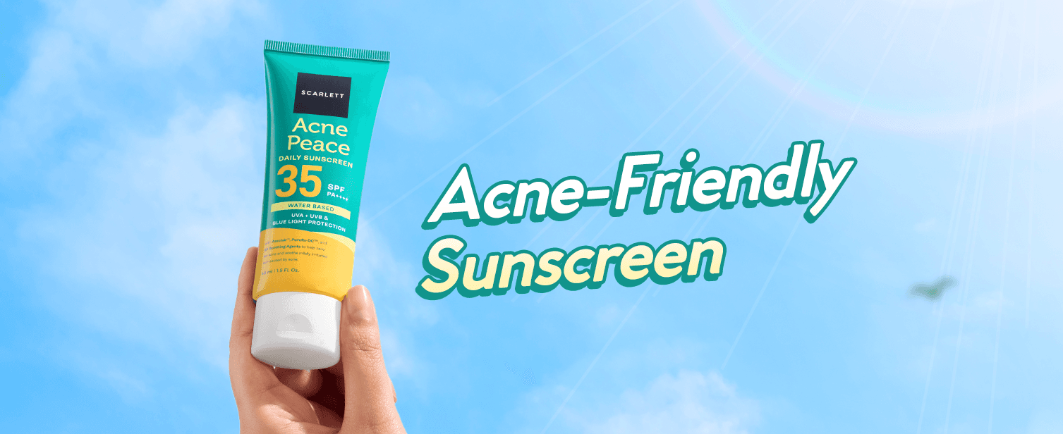 Sunscreen untuk Kulit Berjerawat: Panduan Memilih yang Non-Comedogenic dan Aman